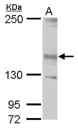 Anti-JARID2 antibody used in Western Blot (WB). GTX129020